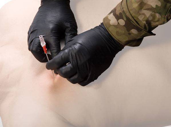  North American Rescue ARS Decompression Needle