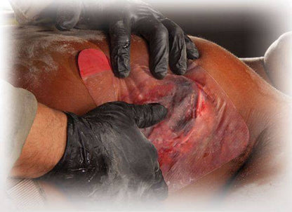  North American Rescue HyFin Chest Seal