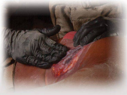 North American Rescue HyFin Chest Seal