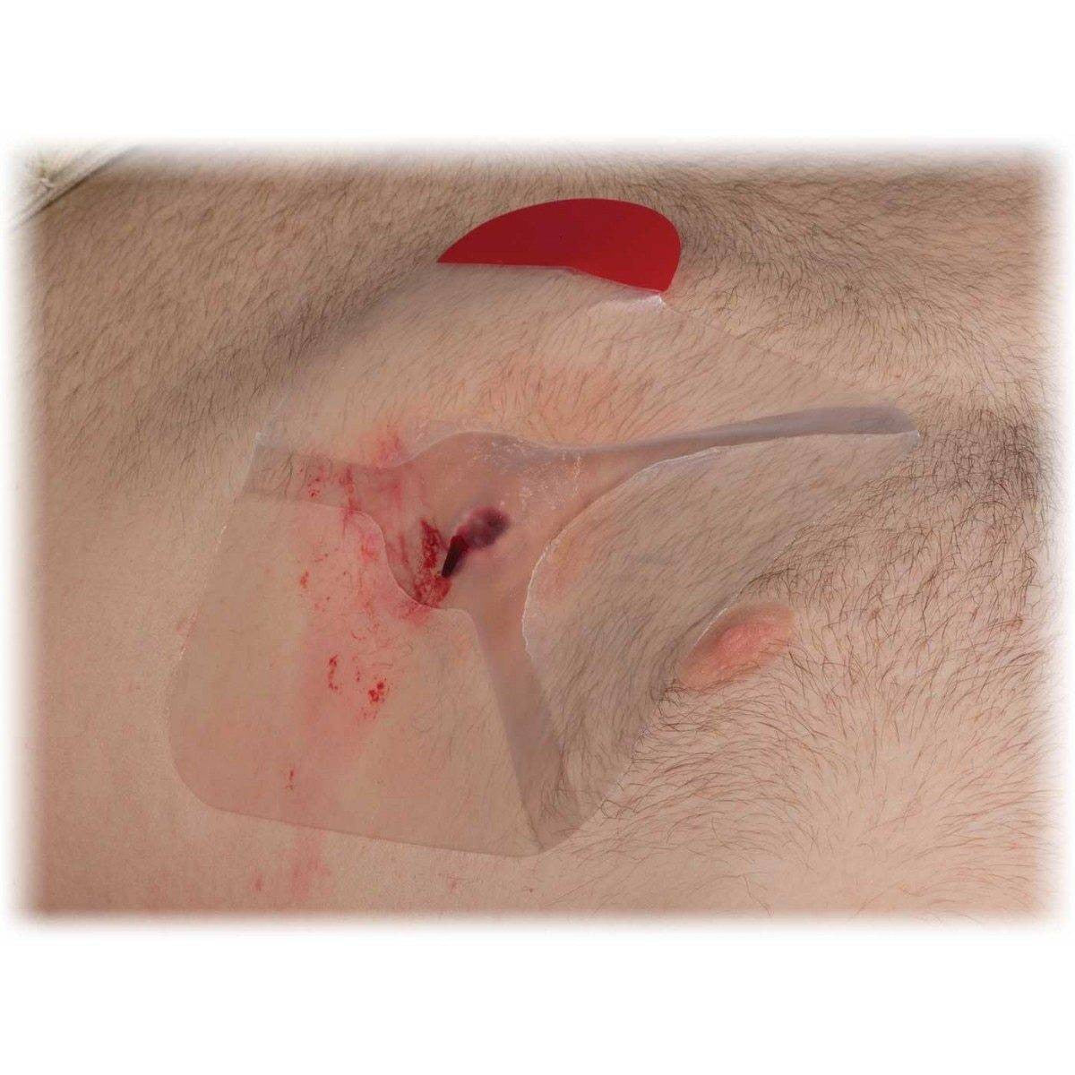  North American Rescue HyFin Chest Seal - Twin Pack