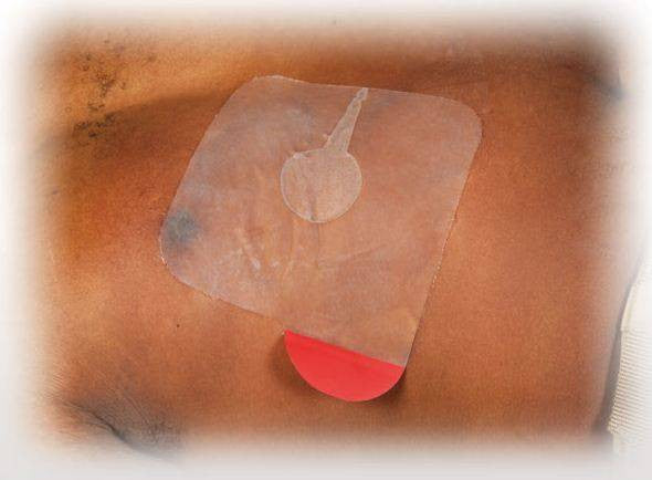  North American Rescue HyFin Vent Chest Seal