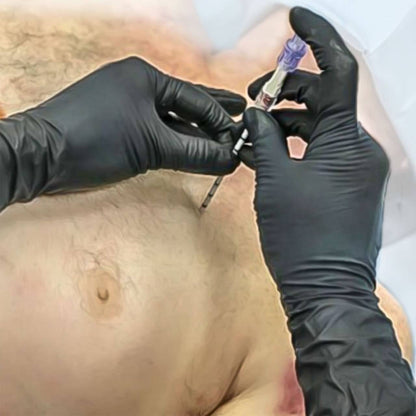  North American Rescue SPEAR Decompression Needle